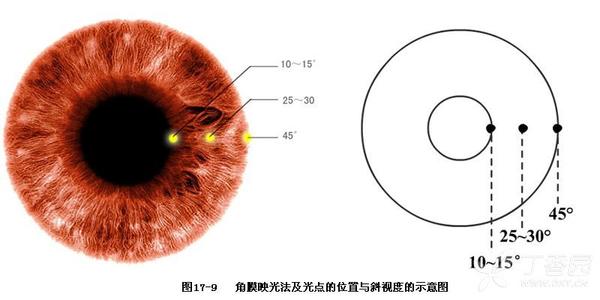 验光师培训 验光师培训学校 验光配镜培训 验光配镜培训学校 正真验光配镜培训