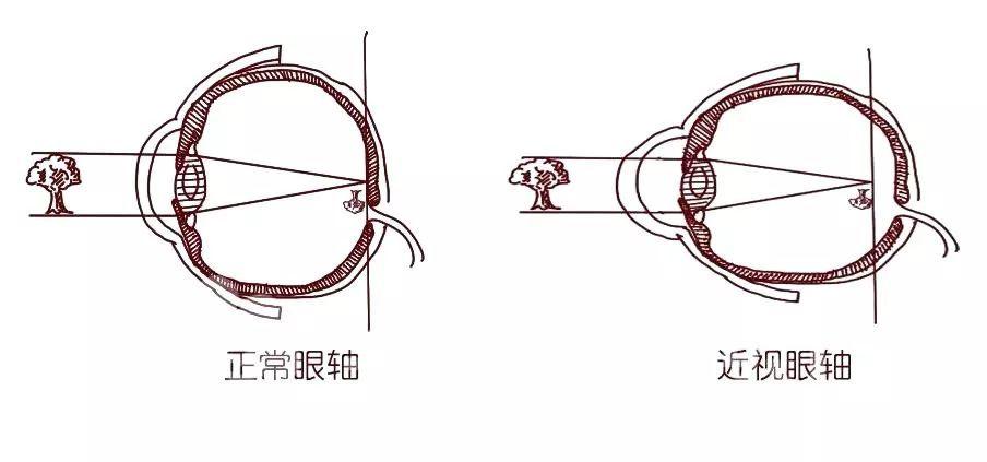 验光师培训 验光师培训学校 验光配镜培训 验光配镜培训学校 正真视光学院 